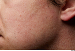 HD Skin Brandon Davis cheek face head skin pores skin…